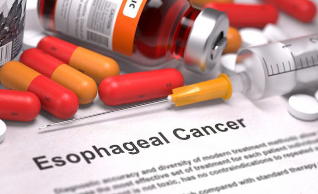 Oesophageal cancers risk prevent