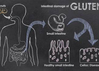 intolleranza al glutine fibrosi cistica proteina CFTR celiachia