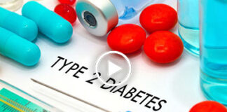 сахарный диабет 2 типа LuCI Luminal Coating of the Intestine таблетка желудочного шунтирования