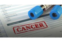 Un nouveau test sanguin pour les cancers indétectables à un stade précoce test sanguin dépistage du cancer détection précoce CancerSEEK