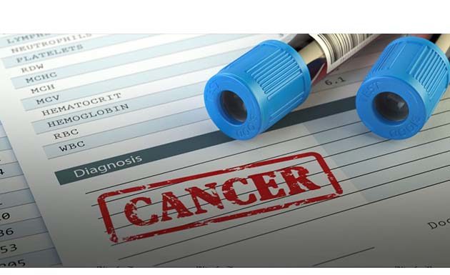 аналіз крыві, скрынінг на рак, ранняе выяўленне CancerSEEK