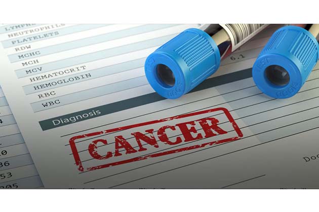 vérvizsgálat rákszűrés korai felismerés CancerSEEK