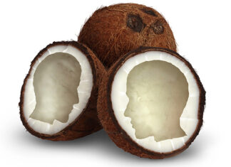 അൽഷിമേഴ്സ് രോഗം: വെളിച്ചെണ്ണ തലച്ചോറിലെ കോശങ്ങളിലെ ഫലകങ്ങൾ കുറയ്ക്കുന്നു അൽഷിമേഴ്സ് ഡിസീസ് കോക്കനട്ട് പ്ലാക്കുകൾ തലച്ചോറിലെ അമിലോയിഡ് മുൻഗാമി പ്രോട്ടീൻ