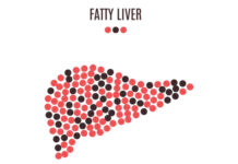 Një përditësim në kuptimin e sëmundjes së mëlçisë yndyrore jo-alkoolike Proteina e sëmundjes së mëlçisë yndyrore jo-alkoolike mitofusin 2
