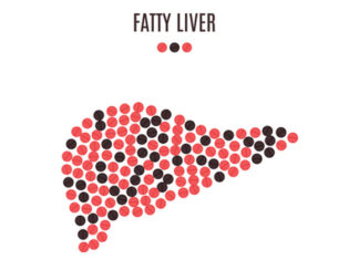 Non-alcoholic Fatty liver disease protein mitofusin 2