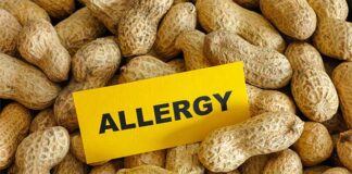 मूंगफली एलर्जी खाद्य एलर्जी इम्यूनोथेरेपी