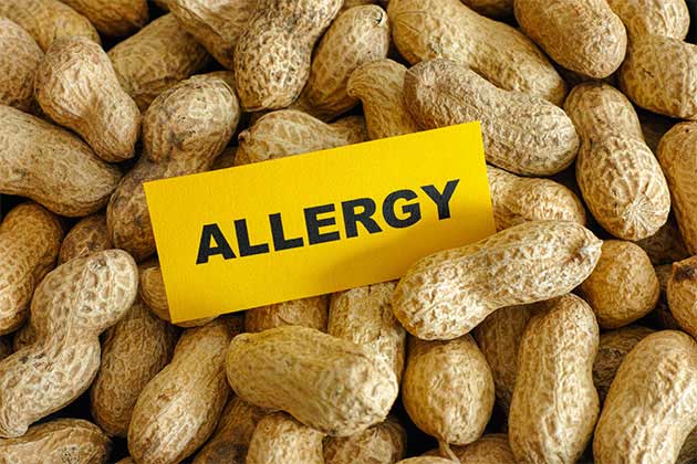 मूंगफली एलर्जी खाद्य एलर्जी इम्यूनोथेरेपी