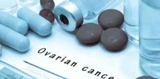 Ovarian Cancer tumour antibody immunotherapy
