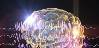癫痫发作检测脑植入物