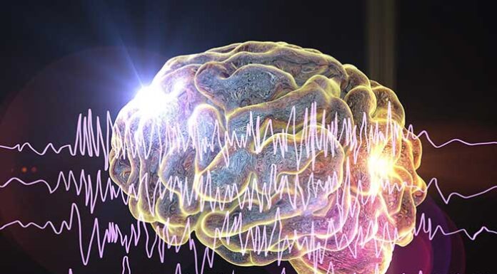 epileptic seizures detection brain implant