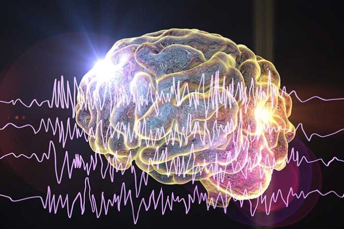 implant cérébral de détection des crises d'épilepsie