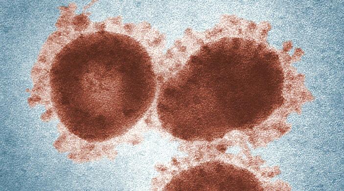 Thapsigargin (TG): Ein potenzieller Anti-Krebs- und Breitspektrum-Antivirus-Wirkstoff, der gegen SARS-CoV-2 wirksam sein könnte
