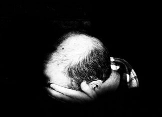 Kişi Nümunəvi Keçəllik üçün Minoksidil: Aşağı Konsentrasiyalar Daha Effektivdir? Kişi Nümunəsi Keçəllik Minoksidil Konsentrasiyaları