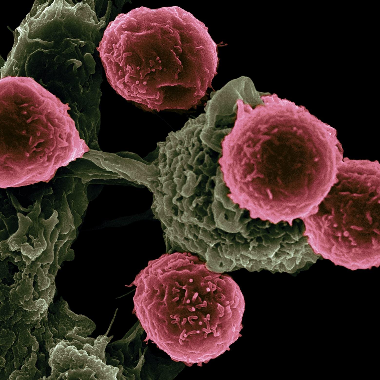 Одобрение сотровимаба в Великобритании: моноклональное антитело, эффективное против омикрона, также может работать для будущих вариантов