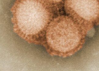 Deltamicron: Delta-Omicron rekombinantný s hybridnými genómami Deltamicron: Delta-Omicron rekombinantný s hybridnými genómami