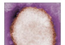 Monkeypox virus (MPXV) variants given new names