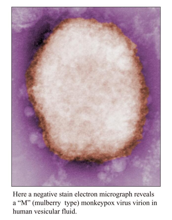Las variantes del virus de la viruela del mono (MPXV) reciben nuevos nombres