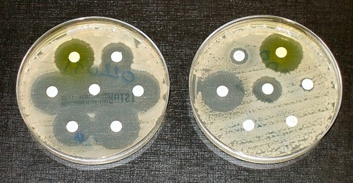 Antimikrobiese weerstand (AMR): 'n nuwe antibiotika Zosurabalpin (RG6006) toon belofte in pre-kliniese proewe