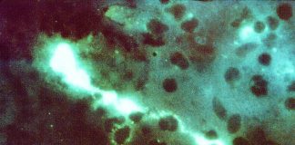 Psitacosis en Europa: un aumento inusual de casos de Chlamydophila psittaci
