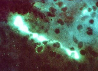 Орнитоз в Европе: необычный рост случаев Chlamydophila psittaci Орнитоз в Европе: необычный рост случаев Chlamydophila psittaci