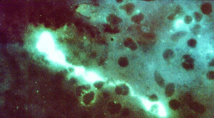 Psittacose in Europa: een ongebruikelijke toename van gevallen van Chlamydophila psittaci