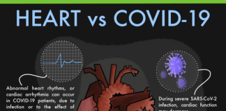 कोविड-19: गंभीर फेफड़ों का संक्रमण "कार्डियक मैक्रोफेज शिफ्ट" के माध्यम से हृदय को प्रभावित करता है