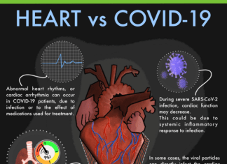 COVID-19: Ernstige longinfectie beïnvloedt het hart door ‘cardiale macrofaagverschuiving’