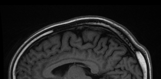 MRI Manusia Ultra-High Fields (UHF): Otak Hidup diimej dengan 11.7 Tesla MRI Projek Iseult