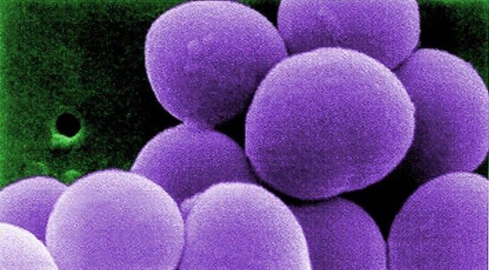 Antibiotikas Zevtera (ceftobiprolio medokarilis), patvirtintas FDA, skirtas gydyti CABP, ABSSSI ir SAB