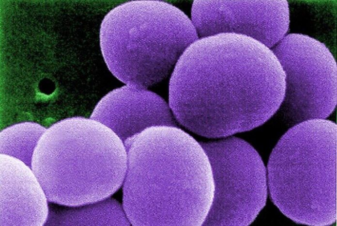 Antibiotiku Zevtera (Ceftobiprole medocaril) i miratuar nga FDA për trajtimin e CABP, ABSSSI dhe SAB