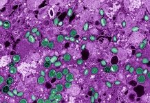 Malattia di Mpox: il tecovirimato antivirale (TPOXX) è risultato inefficace nella sperimentazione clinica Malattia Mpox: il tecovirimato antivirale (TPOXX) ha trovato uno studio inefficace nella Repubblica Democratica del Congo